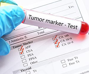 tumor-markers_300X250.jpg tumor-markers_300X250.jpg