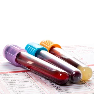 liquid-biopsy_300X300.jpg liquid-biopsy_300X300.jpg