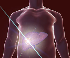 photodynamic-therapy.jpg photodynamic-therapy.jpg